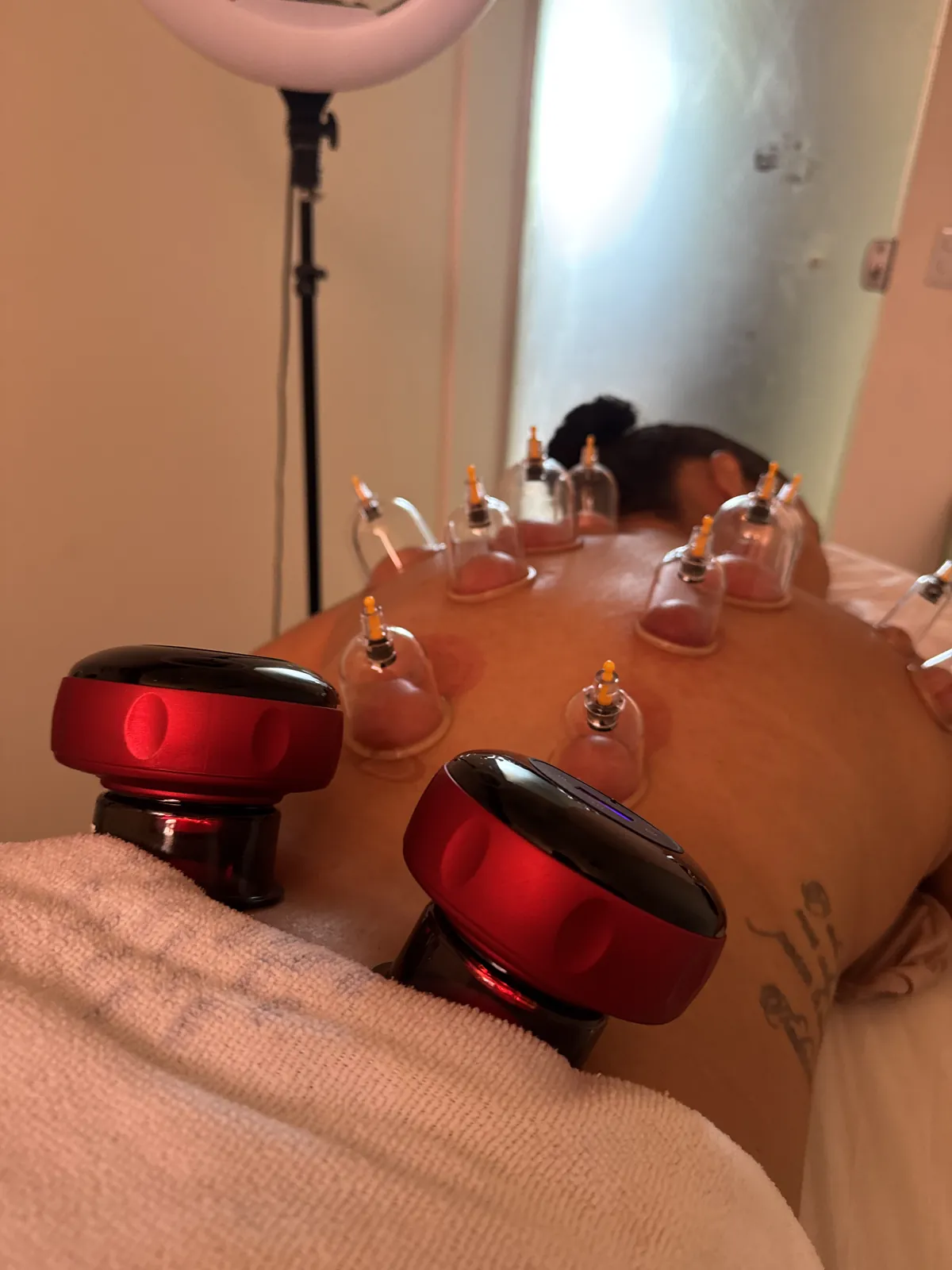 Massagem com ventosas